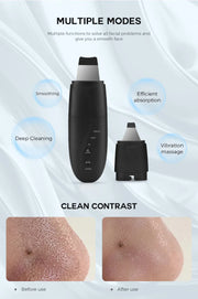 Ultrasonic Skin Scrubber Changeable head Blackhead Remover Peeling Face Cleaner Massager Skin Rejuvenation Beauty Device